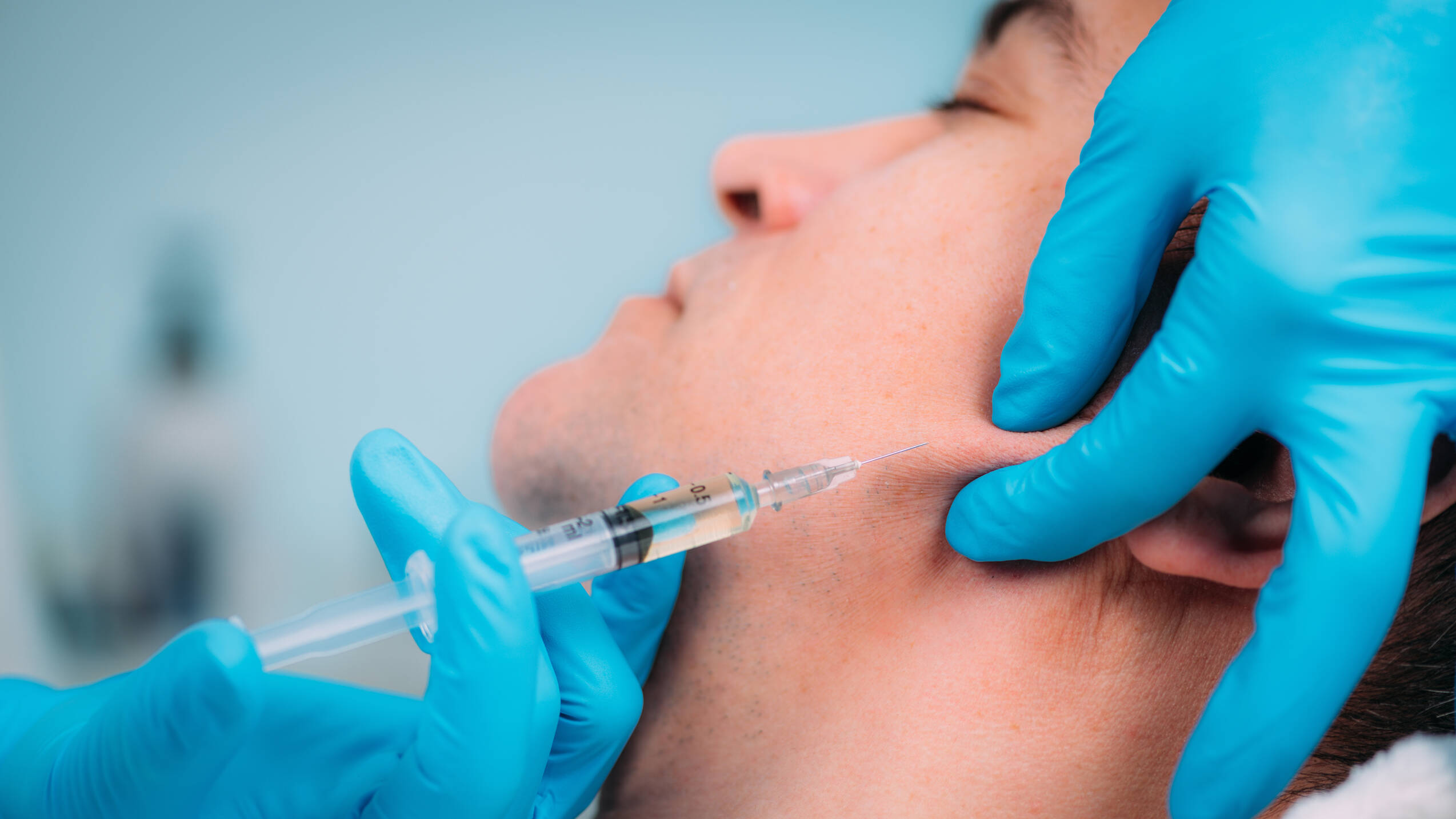 Dermal filler men jawline injection