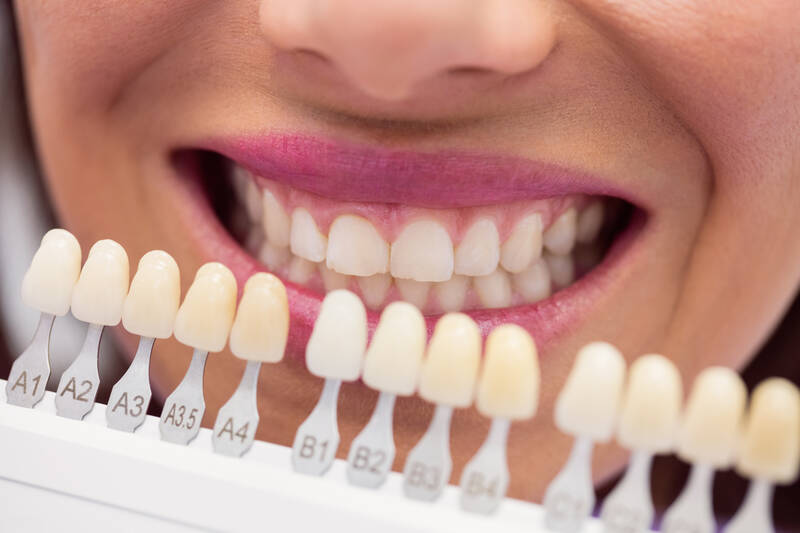 blog/strahlend-weisses-laecheln-professionelles-zahnbleaching-bei-as-aesthetics-darmstadt
